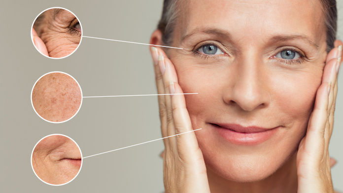 Woman’s ageing skin with wrinkles and age spots